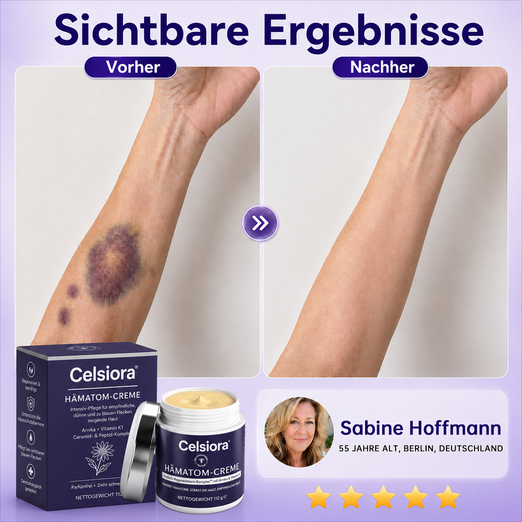 👩‍⚕️🌷 Celsiora® Intensiv-Pflegecreme für empfindliche, zu blauen Flecken neigende Haut